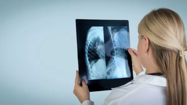 Foto demonstrativa de Escoliose O Impacto na Postura e a Importância do Tratamento Fis