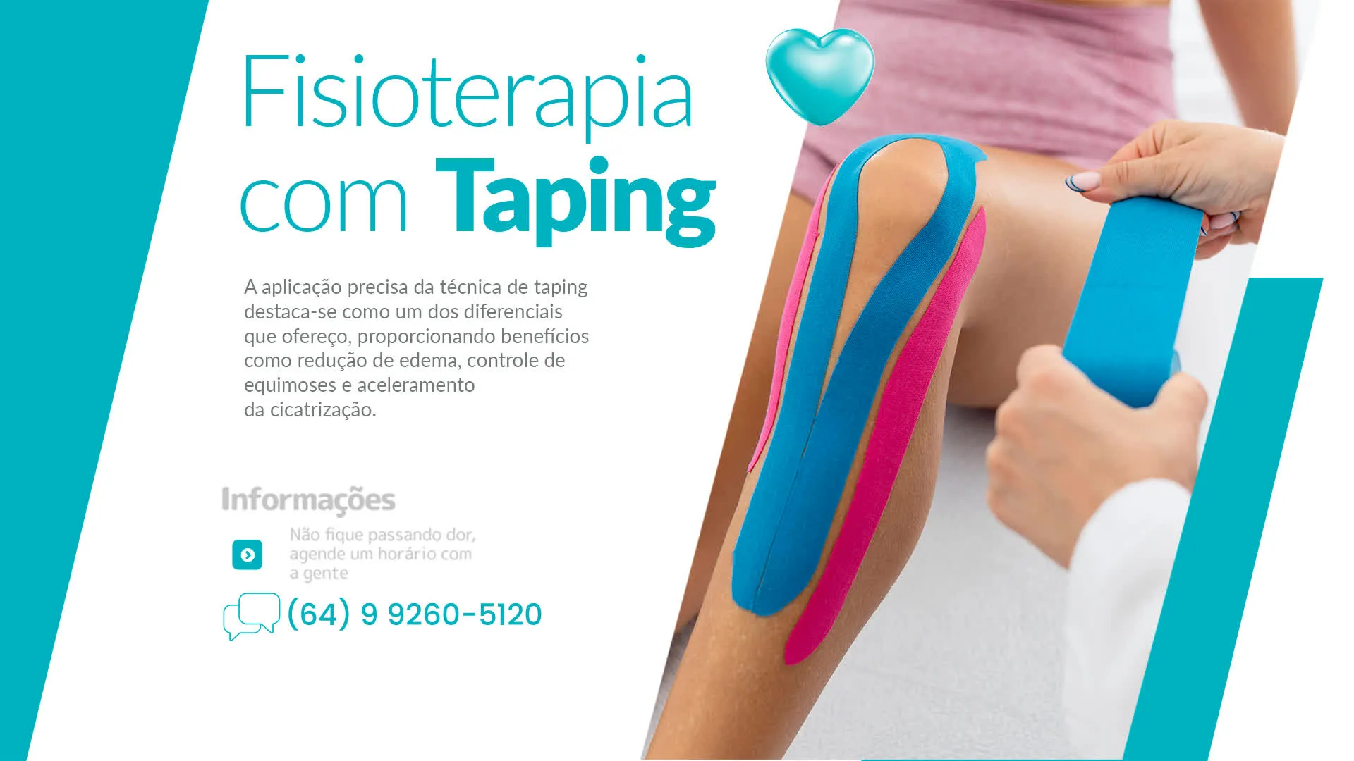 Foto demonstrativa de Fisioterapia com Taping